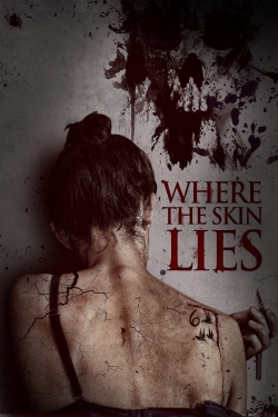 watch free Where the Skin Lies