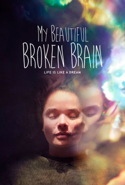 watch free My Beautiful Broken Brain